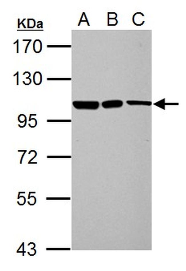 TRIM37 Antibody in Western Blot (WB)