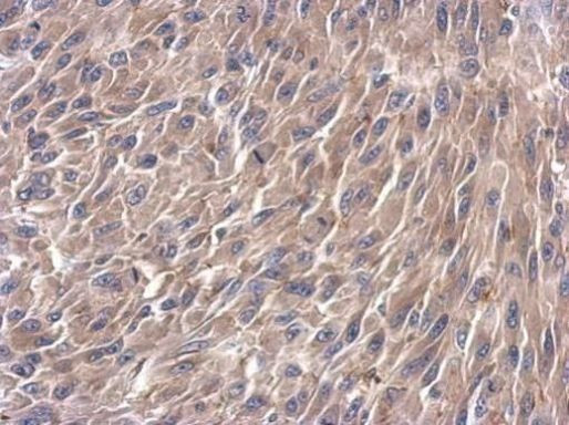 TRIM37 Antibody in Immunohistochemistry (Paraffin) (IHC (P))