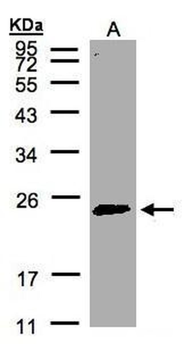 RAB2A Antibody in Western Blot (WB)