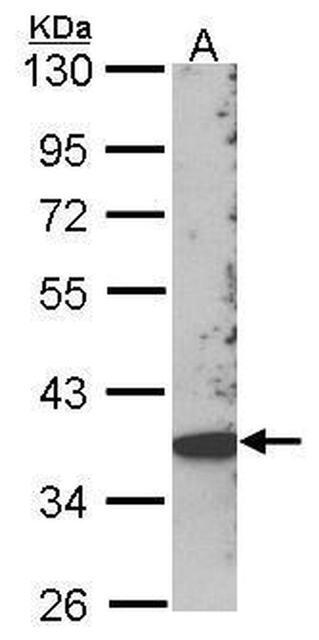SKAP2 Antibody in Western Blot (WB)