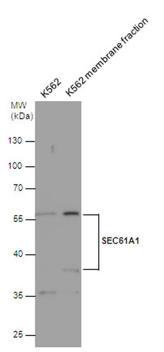 SEC61A1 Antibody in Western Blot (WB)
