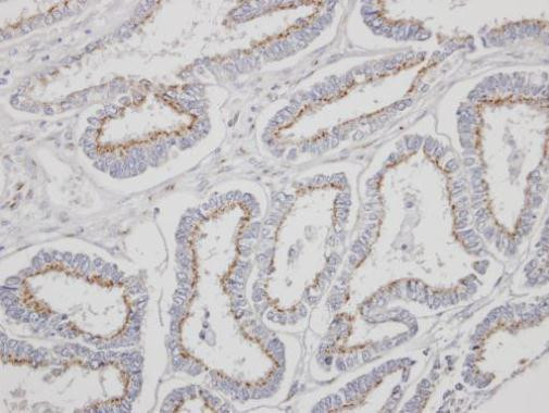 YIPF4 Antibody in Immunohistochemistry (Paraffin) (IHC (P))