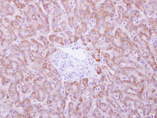 ANKRD45 Antibody in Immunohistochemistry (Paraffin) (IHC (P))