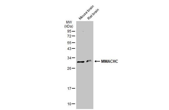 MMACHC Antibody in Western Blot (WB)