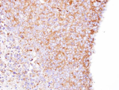 Coronin 1B Antibody in Immunohistochemistry (Paraffin) (IHC (P))