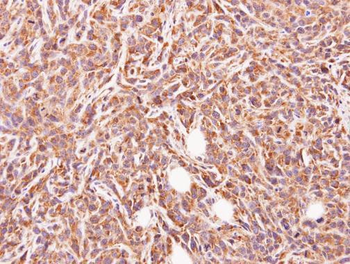 GLYATL1 Antibody in Immunohistochemistry (Paraffin) (IHC (P))