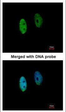 DENND1B Antibody in Immunocytochemistry (ICC/IF)