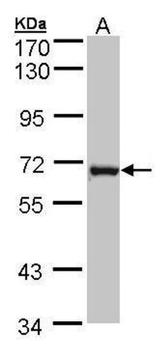 DENND1B Antibody in Western Blot (WB)