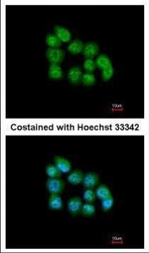 MBNL3 Isoform G Antibody in Immunocytochemistry (ICC/IF)