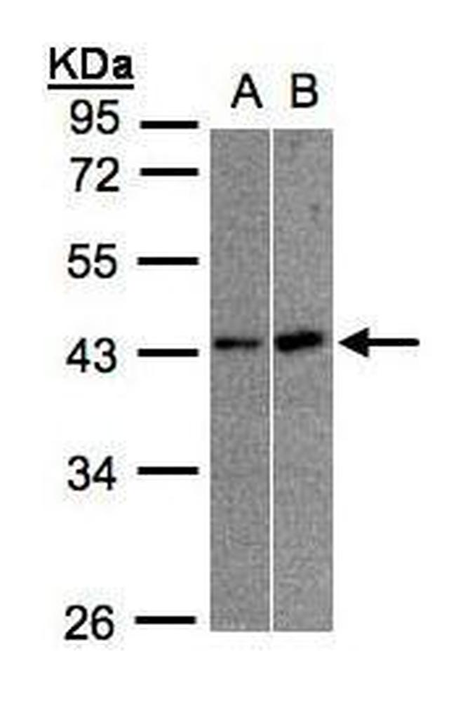 MBNL3 Isoform G Antibody in Western Blot (WB)