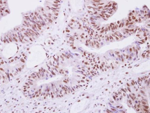 SEPHS1 Antibody in Immunohistochemistry (Paraffin) (IHC (P))