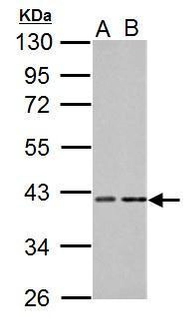 PKA alpha Antibody in Western Blot (WB)