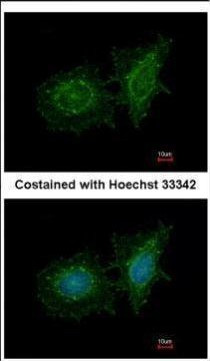 SH3BP1 Antibody in Immunocytochemistry (ICC/IF)