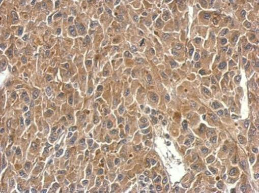 SH3BP1 Antibody in Immunohistochemistry (Paraffin) (IHC (P))