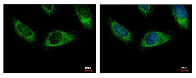 HPS3 Antibody in Immunocytochemistry (ICC/IF)