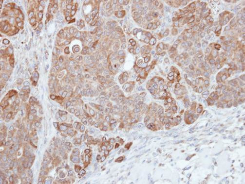 HPS3 Antibody in Immunohistochemistry (Paraffin) (IHC (P))