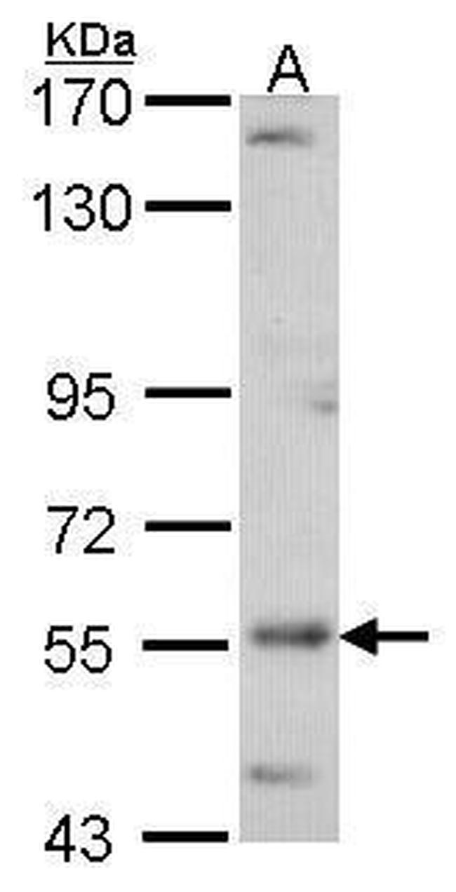 ADCK4 Antibody in Western Blot (WB)