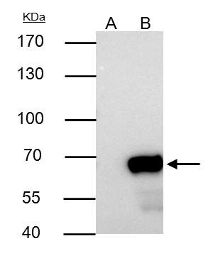 NUP62 Antibody in Immunoprecipitation (IP)