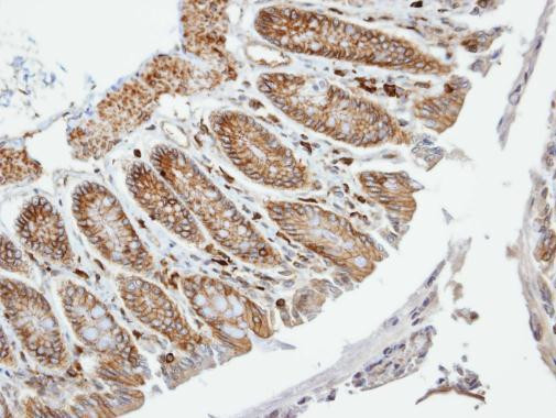 VAM1 Antibody in Immunohistochemistry (Paraffin) (IHC (P))