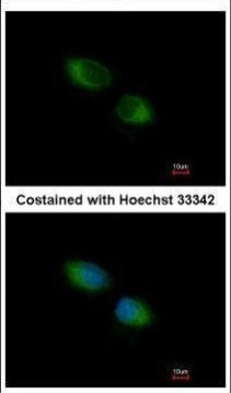 TMX Antibody in Immunocytochemistry (ICC/IF)