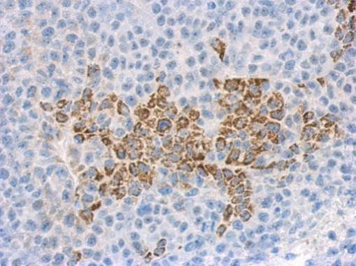 IL1F9 Antibody in Immunohistochemistry (Paraffin) (IHC (P))