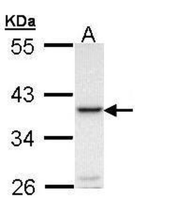 CD254 (RANK Ligand) Antibody in Western Blot (WB)