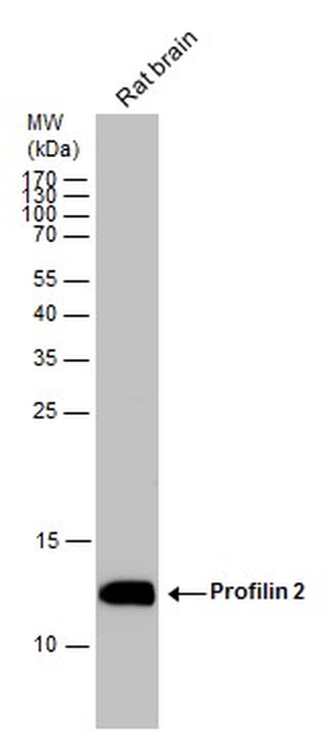 Profilin 2 Antibody in Western Blot (WB)