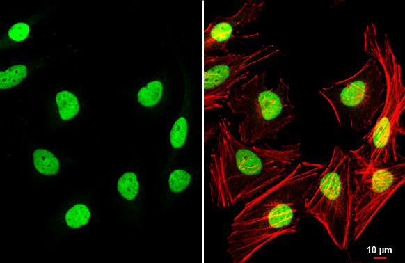 TEAD4 Antibody in Immunocytochemistry (ICC/IF)