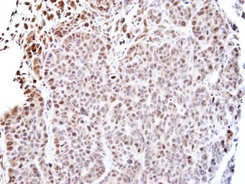 TEAD4 Antibody in Immunohistochemistry (Paraffin) (IHC (P))