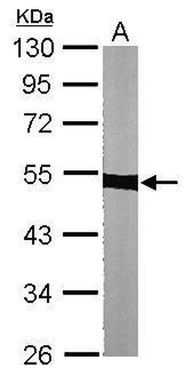 Tubulin alpha-1B Antibody in Western Blot (WB)