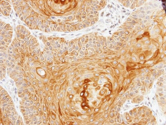 Cytokeratin 10 Antibody in Immunohistochemistry (IHC)