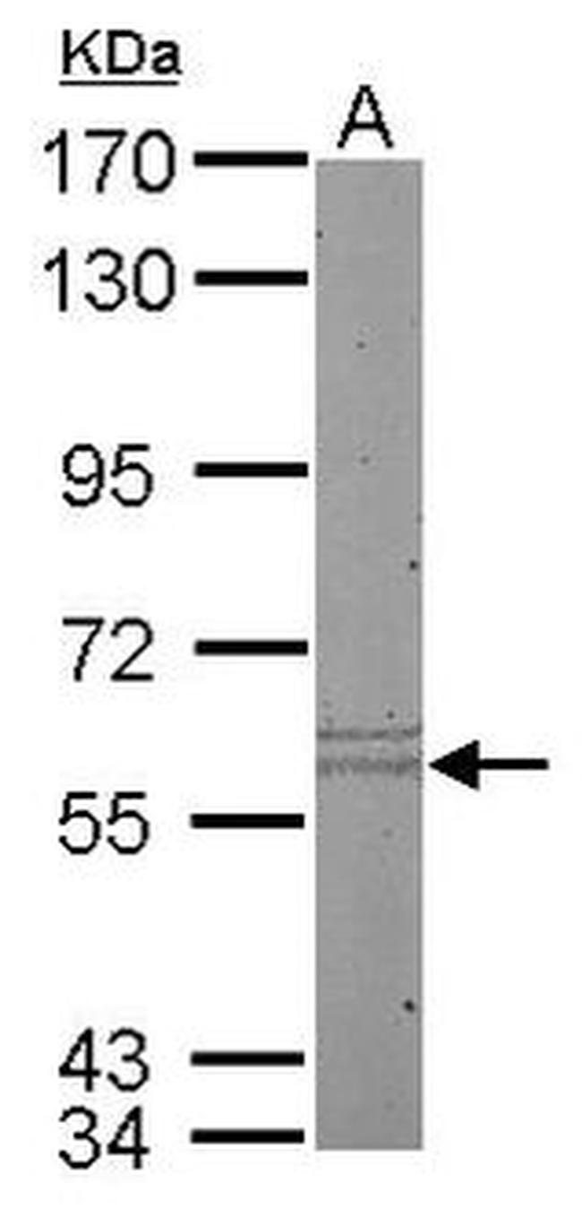 Cytokeratin 10 Antibody in Western Blot (WB)