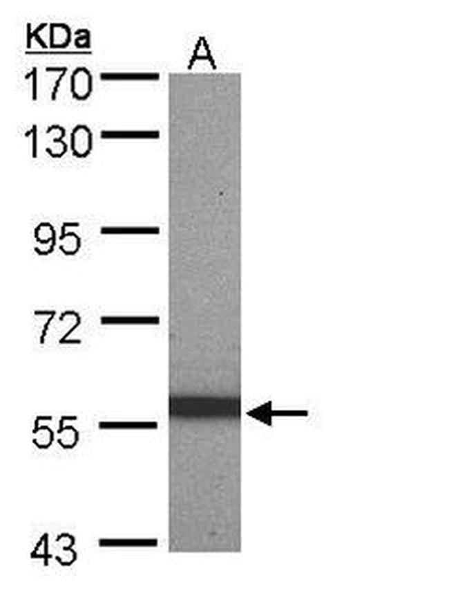 Cytokeratin 10 Antibody in Western Blot (WB)