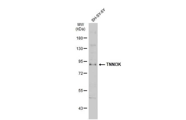 TNNI3K Antibody in Western Blot (WB)