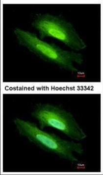 PDE6D Antibody in Immunocytochemistry (ICC/IF)