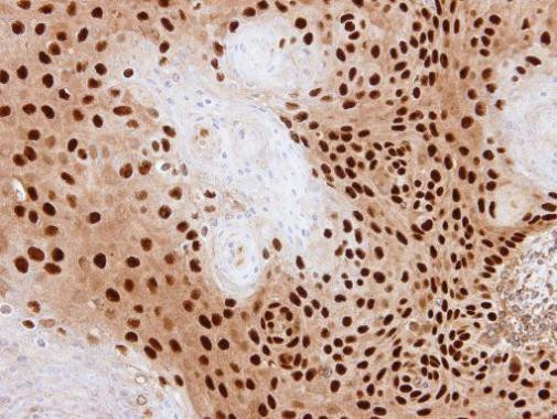 PDE6D Antibody in Immunohistochemistry (Paraffin) (IHC (P))