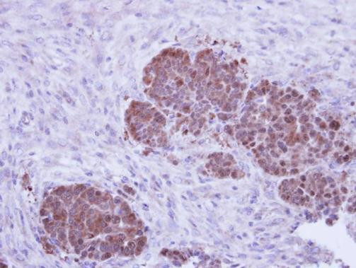 ZPR1 Antibody in Immunohistochemistry (Paraffin) (IHC (P))