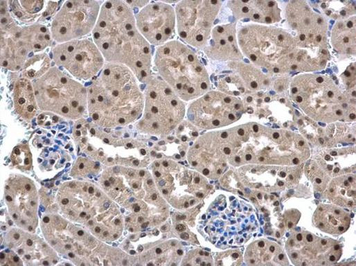 UFD1L Antibody in Immunohistochemistry (Paraffin) (IHC (P))