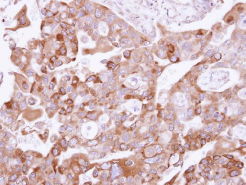 UFD1L Antibody in Immunohistochemistry (Paraffin) (IHC (P))