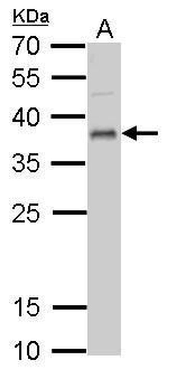 UFD1L Antibody in Western Blot (WB)