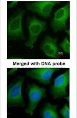 APRT Antibody in Immunocytochemistry (ICC/IF)