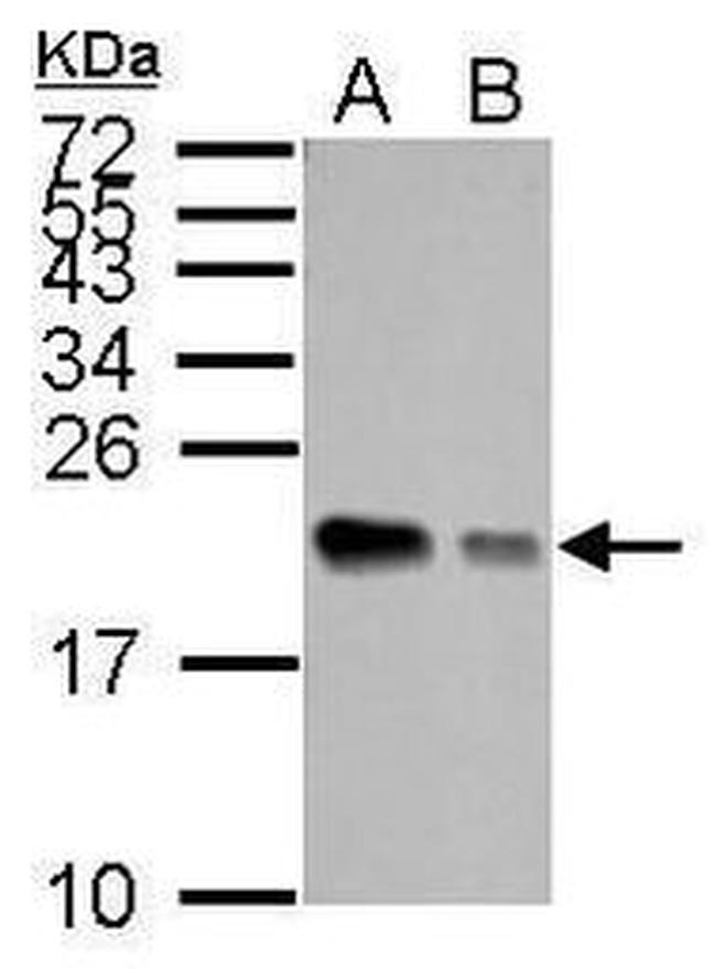 APRT Antibody in Western Blot (WB)