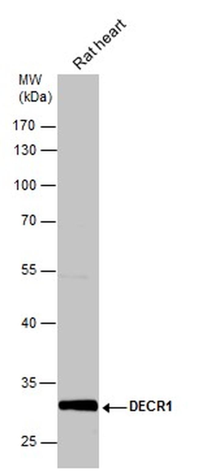 DECR1 Antibody in Western Blot (WB)