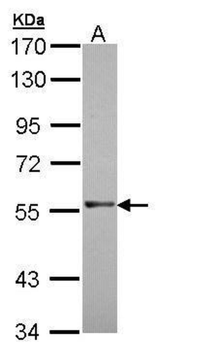 RAG2 Antibody in Western Blot (WB)