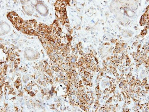 PNLIP Antibody in Immunohistochemistry (Paraffin) (IHC (P))