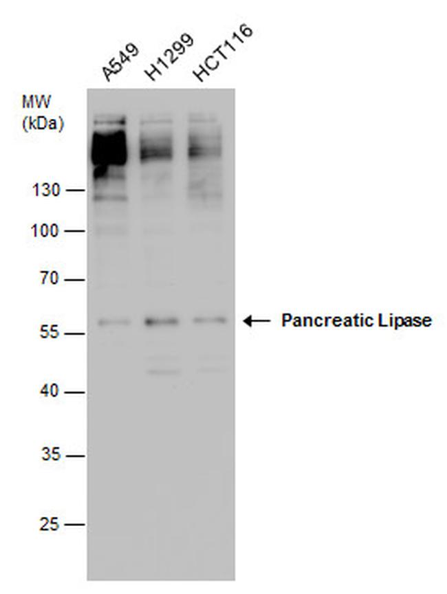 PNLIP Antibody in Western Blot (WB)