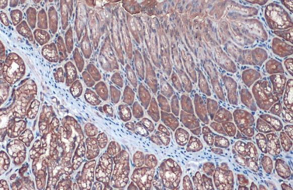 Villin Antibody in Immunohistochemistry (Paraffin) (IHC (P))