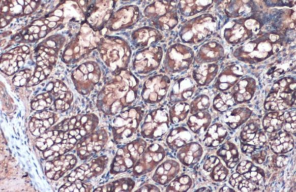 Villin Antibody in Immunohistochemistry (Paraffin) (IHC (P))