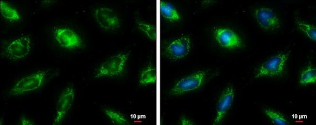 Fumarase Antibody in Immunocytochemistry (ICC/IF)