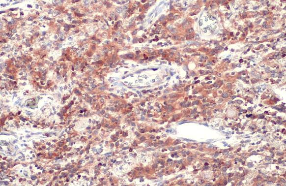 CD74 Antibody in Immunohistochemistry (Paraffin) (IHC (P))